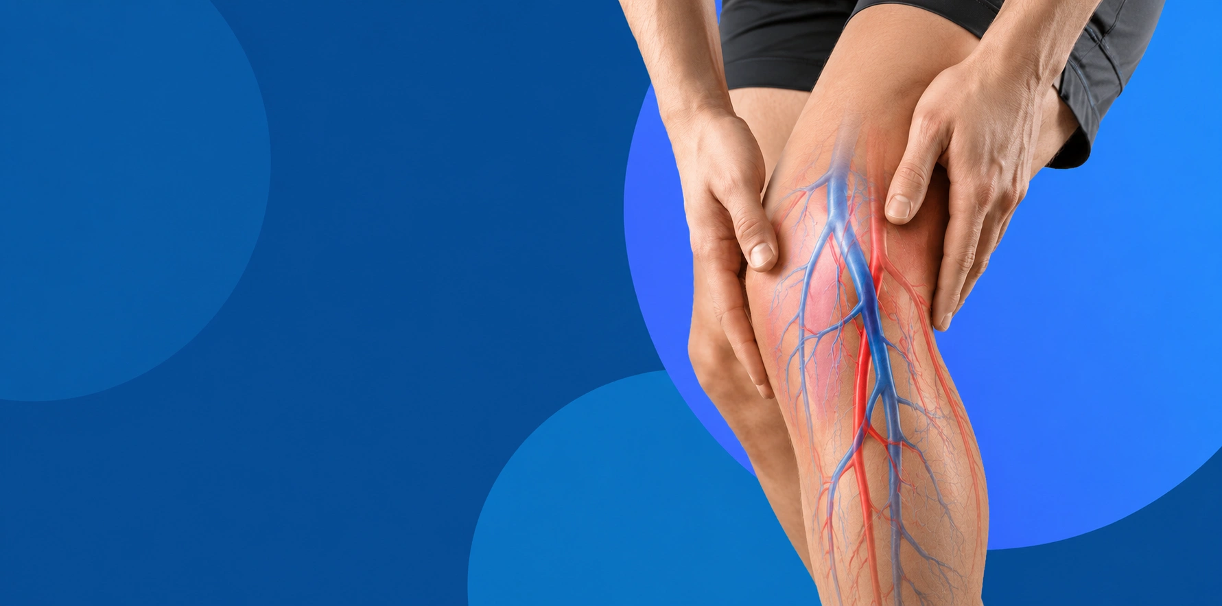 Vascular Surgery