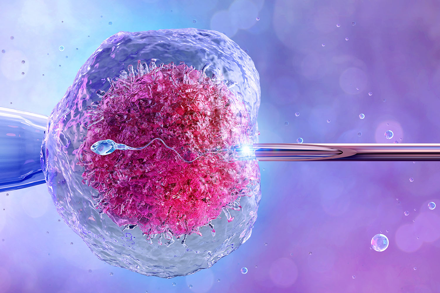 What Is IVF? Procedure & How It Works